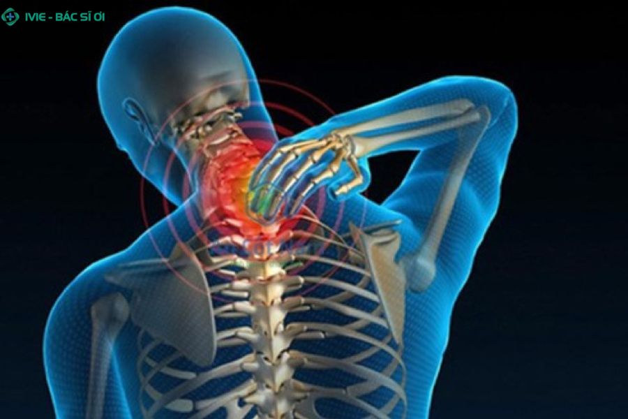 Thoái hóa cột sống cổ khiến các đốt sống và đĩa đệm bị bào mòn theo thời gian
