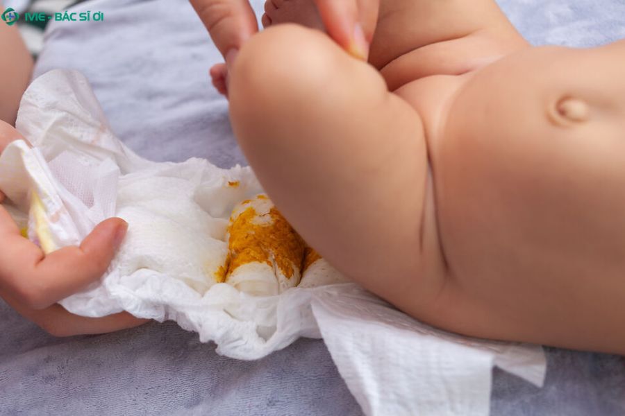 Dấu hiệu phân vàng có nhầy ở trẻ 3 tháng cần đi khám