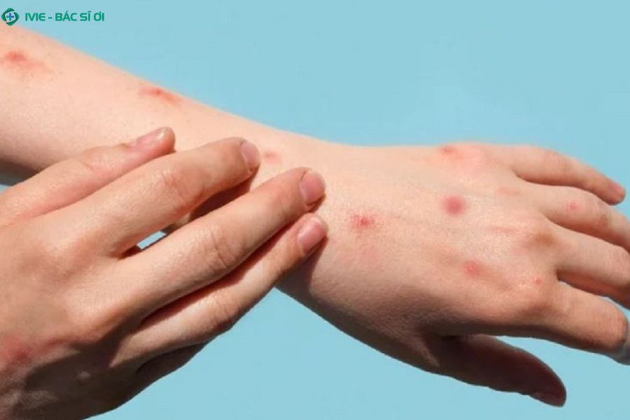 Sự thiếu hụt kiến thức về giáo dục giới tính khiến học sinh đối mặt với nguy cơ mắc bệnh xã hội từ rất sớm