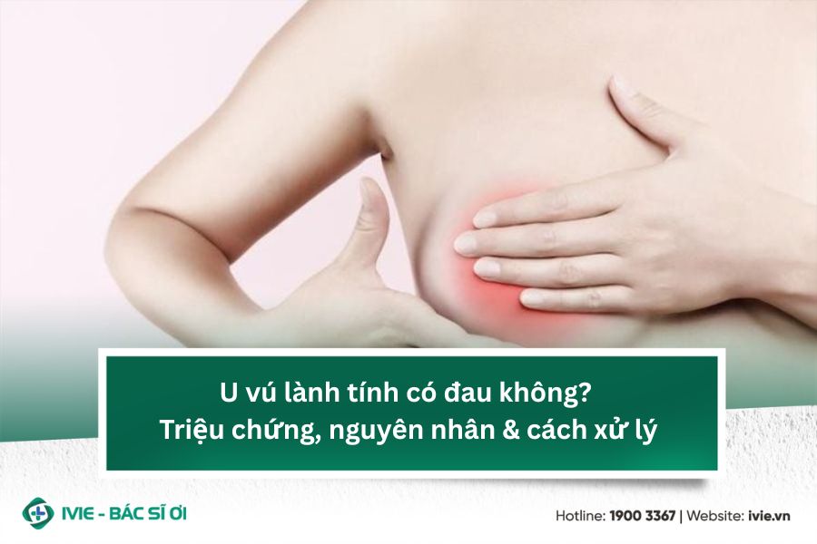 U vú lành tính có đau không? Triệu chứng, nguyên nhân &...