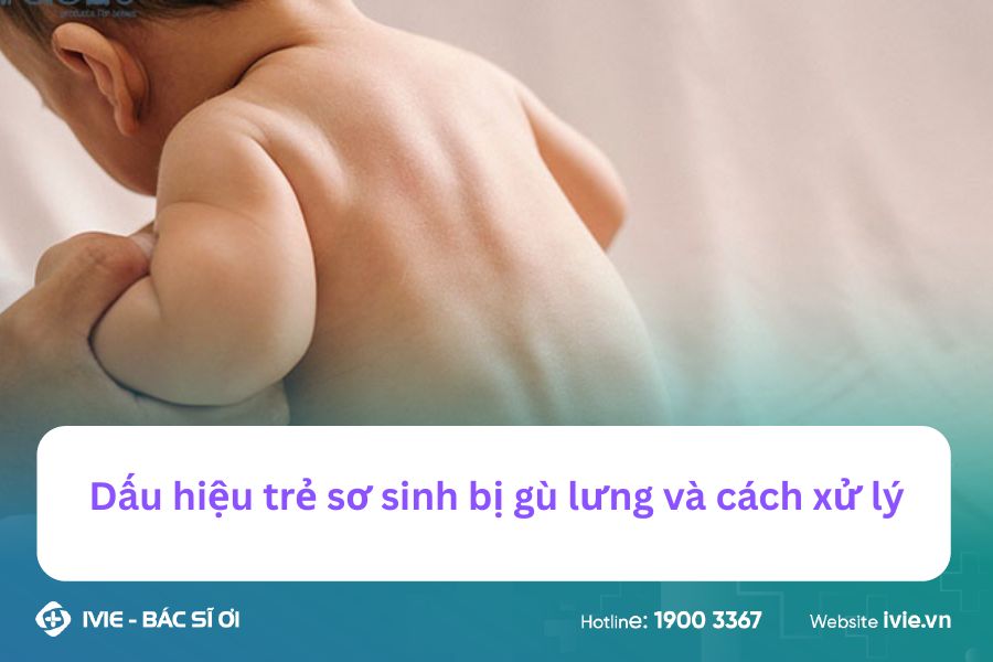 Dấu hiệu trẻ sơ sinh bị gù lưng và cách xử lý