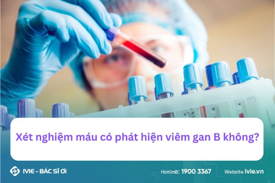 Bác sĩ giải đáp: Xét nghiệm máu có phát hiện viêm gan B...