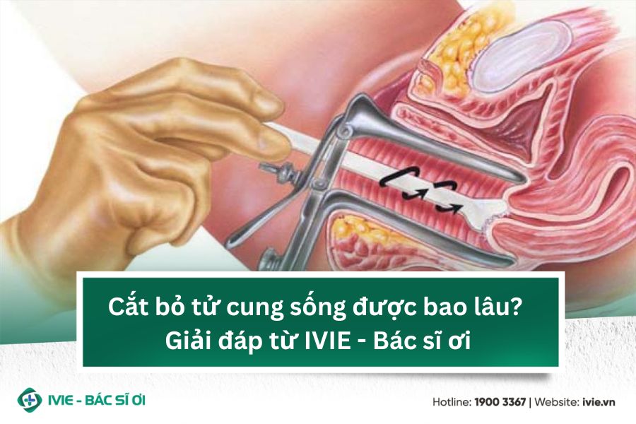 Cắt bỏ tử cung sống được bao lâu? Giải đáp từ IVIE - Bác sĩ ...