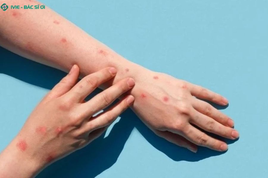 Danh sách các bệnh lý nguy hiểm thường gặp sau khi phát sinh hành vi quan hệ không an toàn