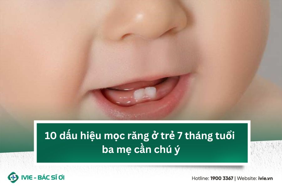 10 dấu hiệu mọc răng ở trẻ 7 tháng tuổi ba mẹ cần chú ý