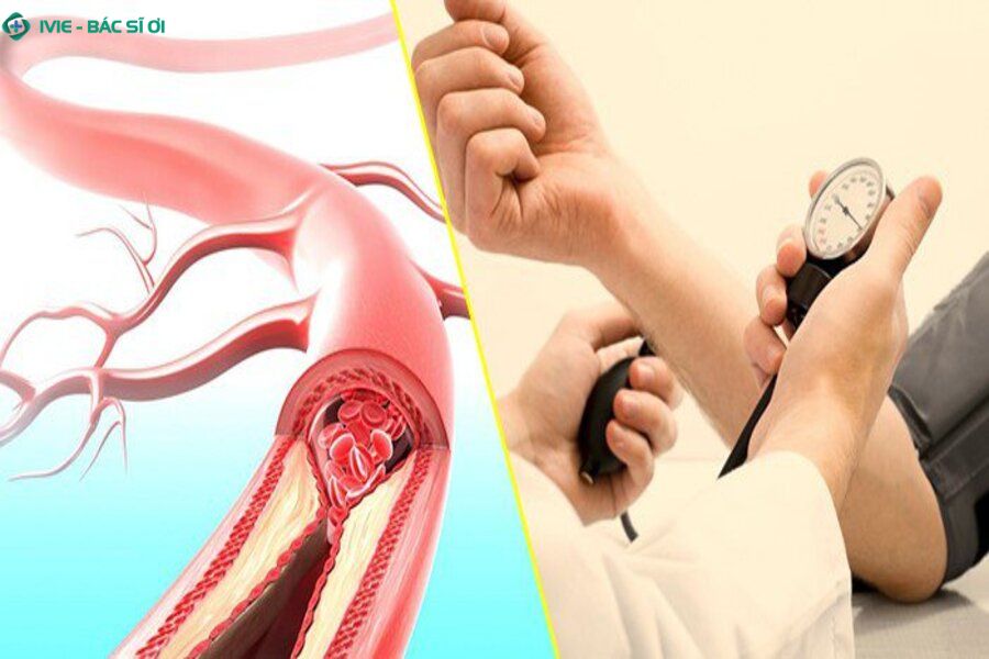 Nhịp tim tăng và huyết áp biến động đột ngột khiến tim phải làm việc nhiều hơn, đặc biệt nguy hiểm với người có bệnh tim nền