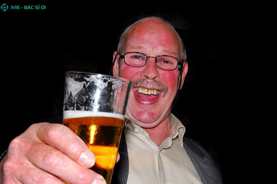 Uống bia đỏ mặt kéo dài có thể làm tăng nguy cơ ung thư và bệnh tim mạch