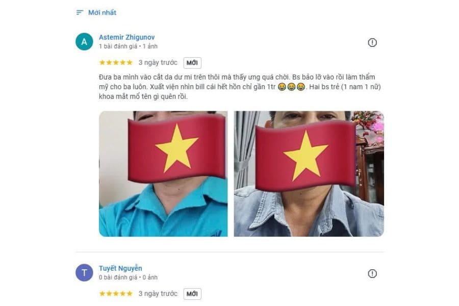 Phẫu thuật cắt mí giúp loại bỏ da thừa, phục hồi tầm nhìn và tạo nếp mí tự nhiên