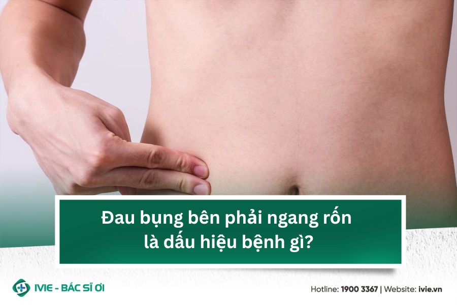 Đau bụng bên phải ngang rốn là dấu hiệu bệnh gì?