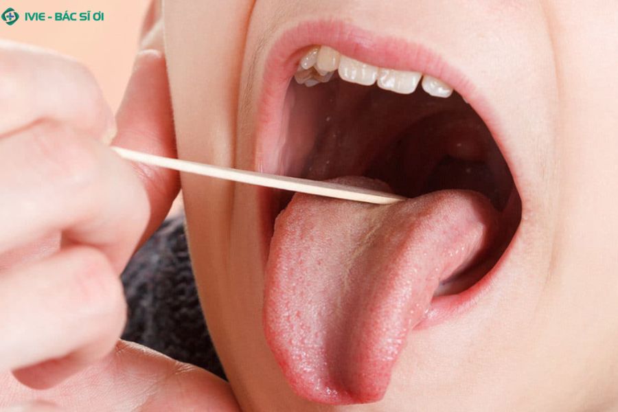 Thời gian hồi phục viêm amidan ở trẻ thường khỏi sau 7-10 ngày nếu được điều trị và chăm sóc đúng cách