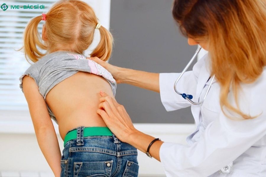 Chẩn đoán chính xác là cơ sở để lên kế hoạch điều trị gù lưng phù hợp cho từng trẻ