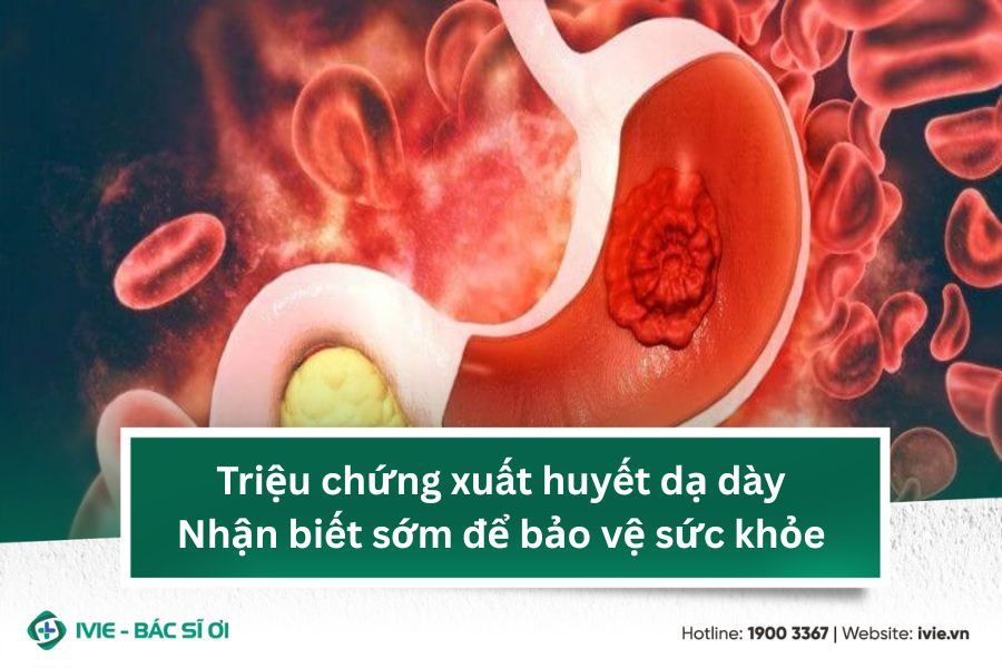 Triệu chứng xuất huyết dạ dày: Nhận biết sớm để bảo vệ sức...