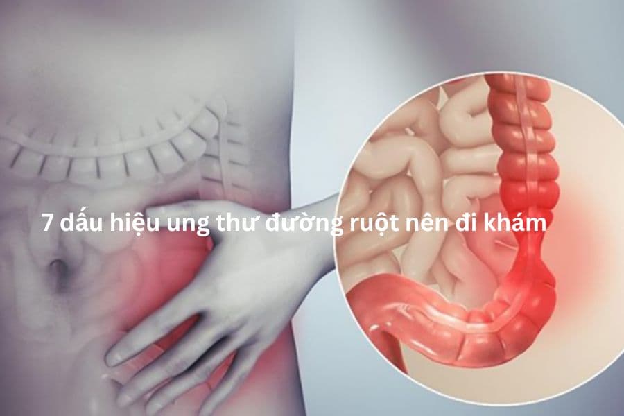 7 Dấu hiệu ung thư đường ruột nên đi khám
