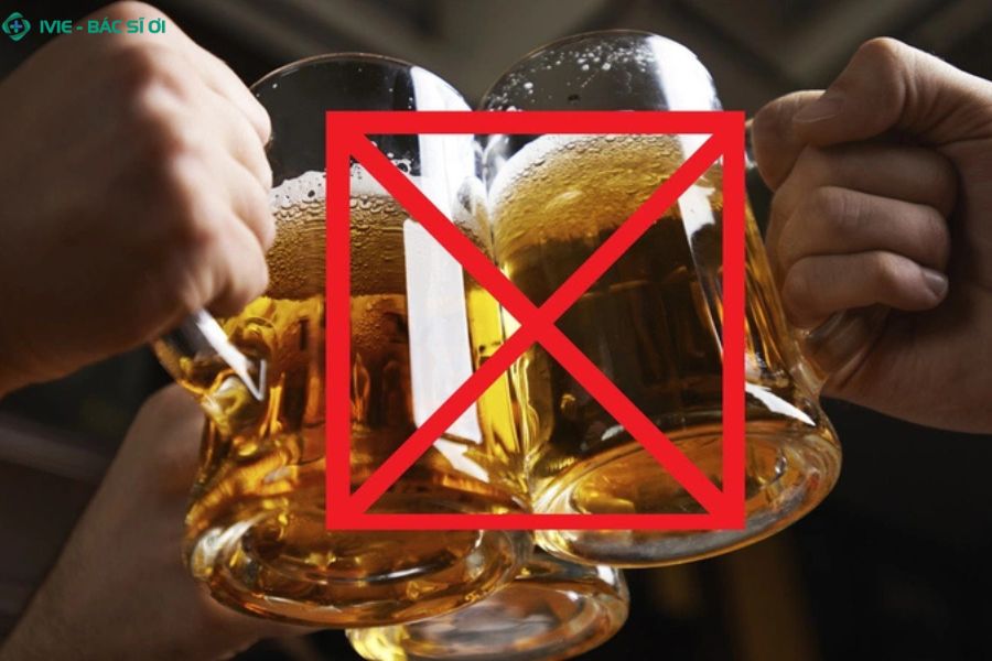 Các thực phẩm cay, nhiều dầu mỡ, rượu bia cần kiêng sau nội soi đại tràng để tránh kích ứng ruột