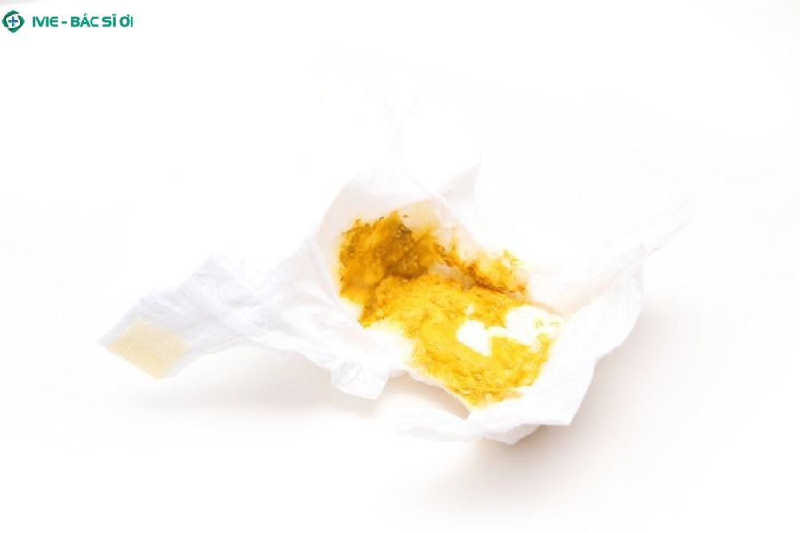 Phân và nhầy trong phân của trẻ 3 tháng tuổi có bình thường không?