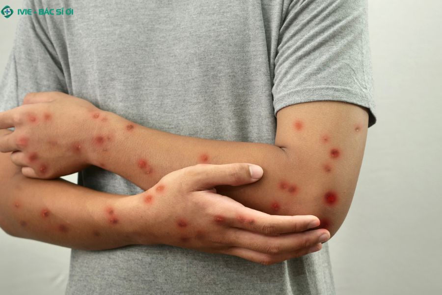 Các loại virus, vi khuẩn là tác nhân chính gây ra các bệnh lây truyền qua đường tình dục