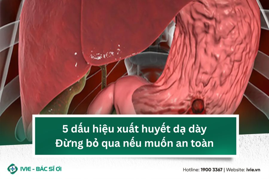 5 dấu hiệu xuất huyết dạ dày - Đừng bỏ qua nếu muốn an toàn