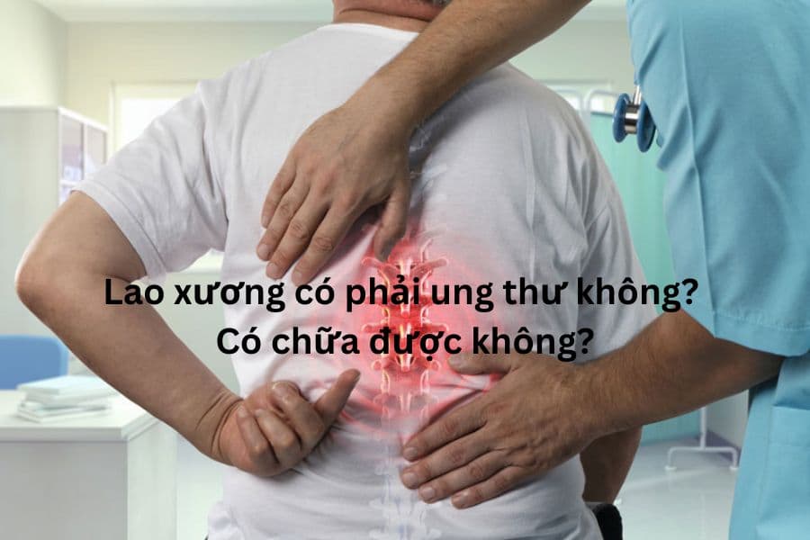 Lao xương có phải ung thư không? Có chữa được không?