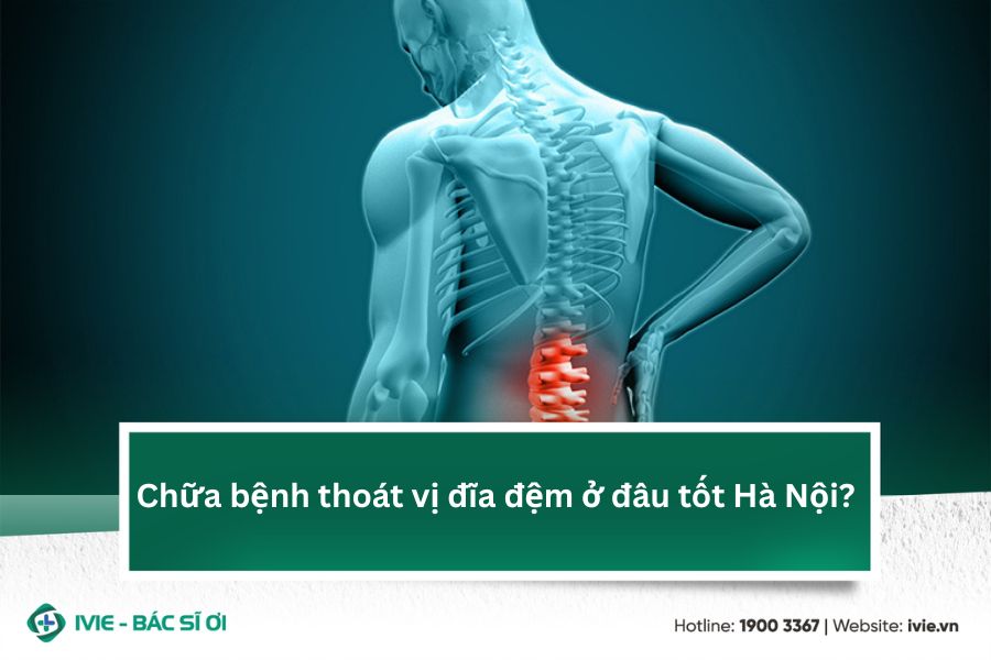 Chữa bệnh thoát vị đĩa đệm ở đâu tốt tại Hà Nội?