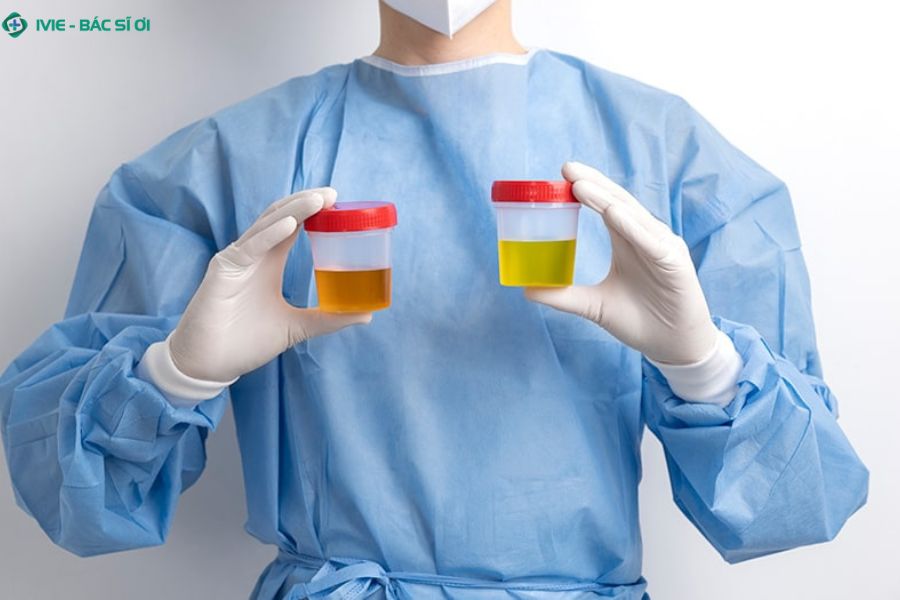 Nước tiểu để qua đêm có cặn trắng thường vô hại