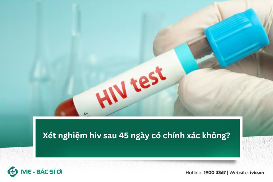 Xét nghiệm hiv sau 45 ngày có chính xác không?
