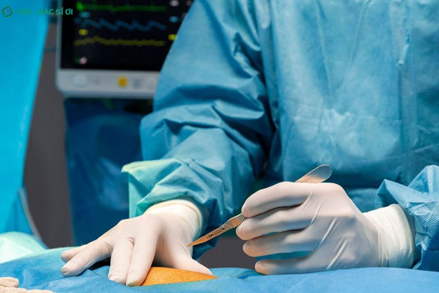 Tìm hiểu về phương pháp mổ ruột thừa