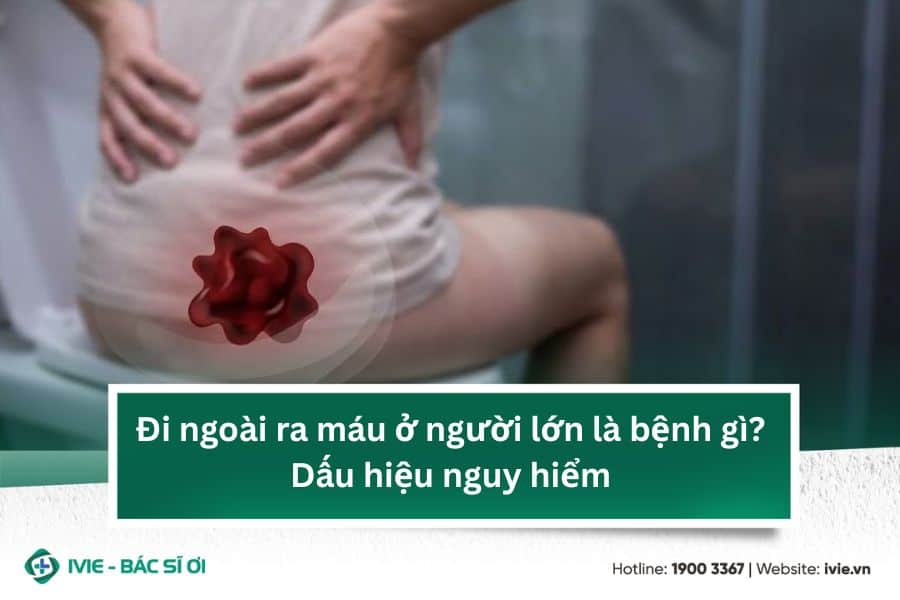 Đi ngoài ra máu ở người lớn là bệnh gì? Dấu hiệu nguy hiểm