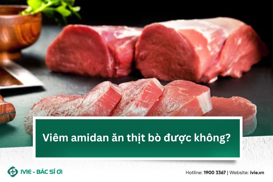 Viêm amidan ăn thịt bò được không?