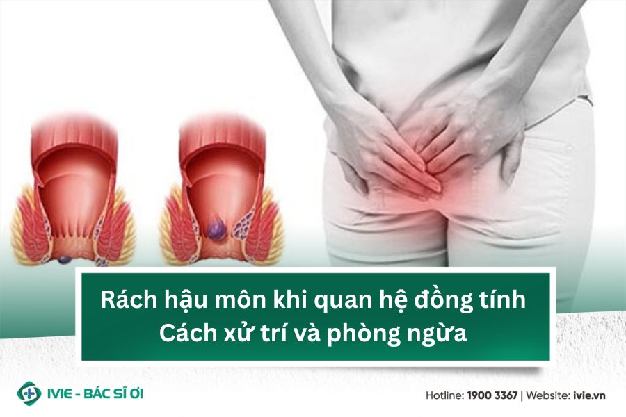 Rách hậu môn khi quan hệ đồng tính: Cách xử trí và phòng...