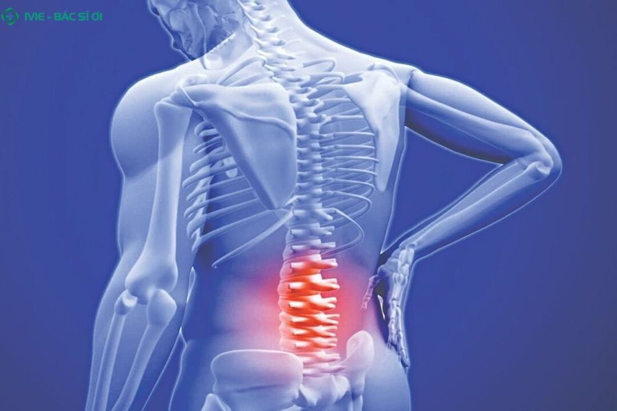 Cần lưu ý trước khi quan hệ sau khi mổ thoát vị đĩa đệm