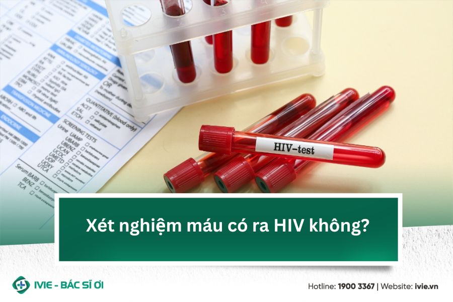 Xét nghiệm máu có ra HIV không?