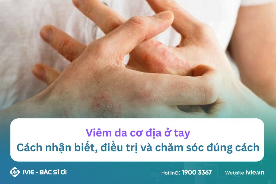Viêm da cơ địa ở tay: Cách nhận biết, điều trị và chăm sóc...