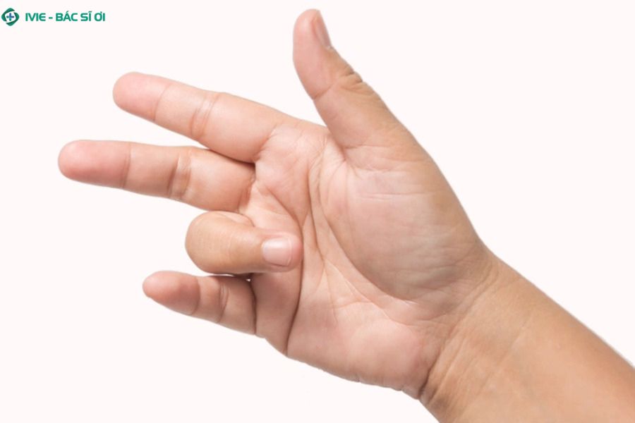 Nguyên nhân đau ngón tay áp út có thể bắt nguồn từ yếu tố cơ học, thói quen sinh hoạt