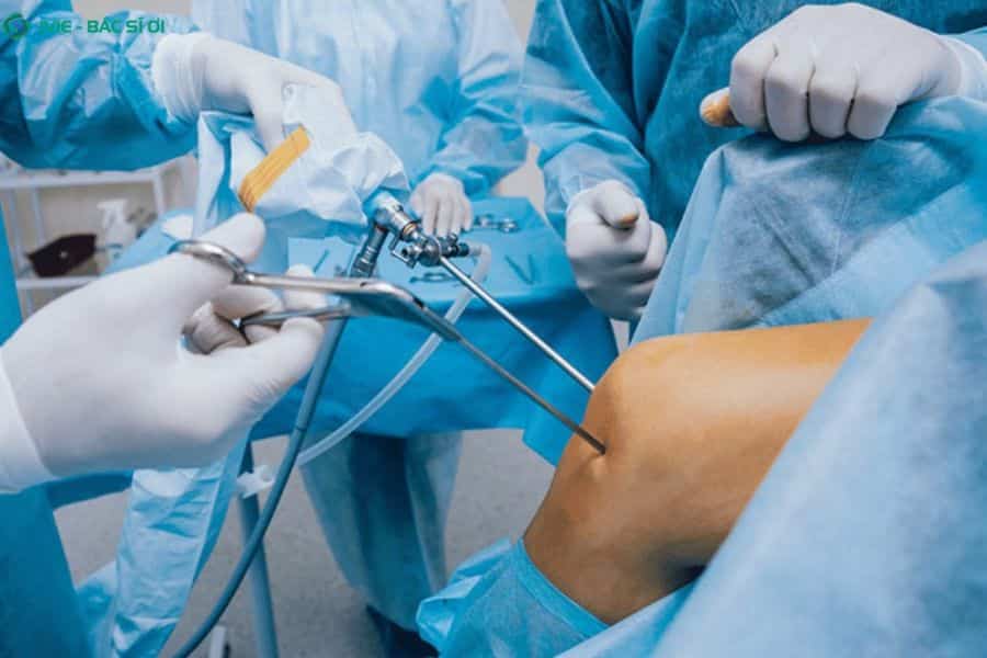 BHYT khống chế trần vật tư khiến người bệnh vẫn phải tự chi trả khoảng 40% - 50% tổng chi phí ca mổ
