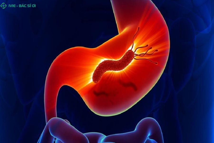 VI khuẩn HP là gì?