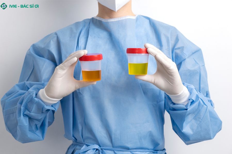 Các xét nghiệm thường được chỉ định khi phát hiện hồng cầu trong nước tiểu