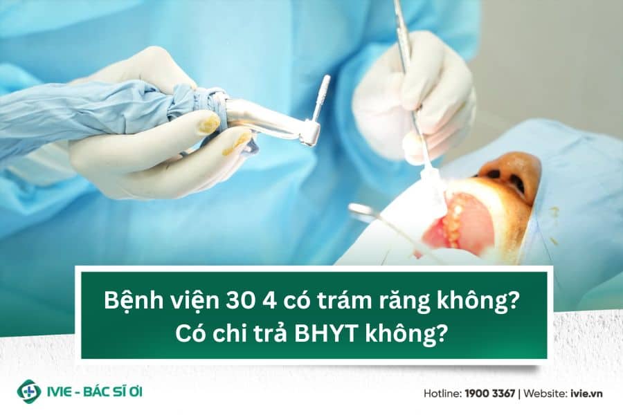 Bệnh viện 30 4 có trám răng không? Có chi trả BHYT không?
