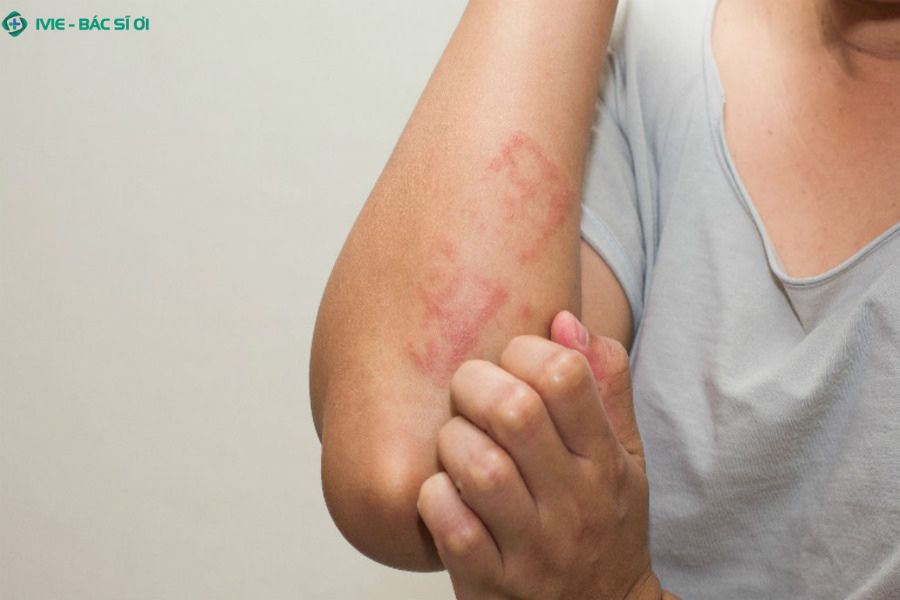 Những triệu chứng bạn cần xét nghiệm ký sinh trùng càng sớm càng tốt