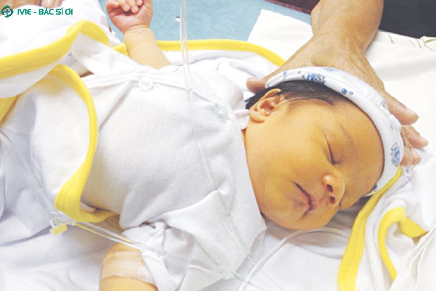 Một số nguyên nhân khiến trẻ bị vàng da kéo dài