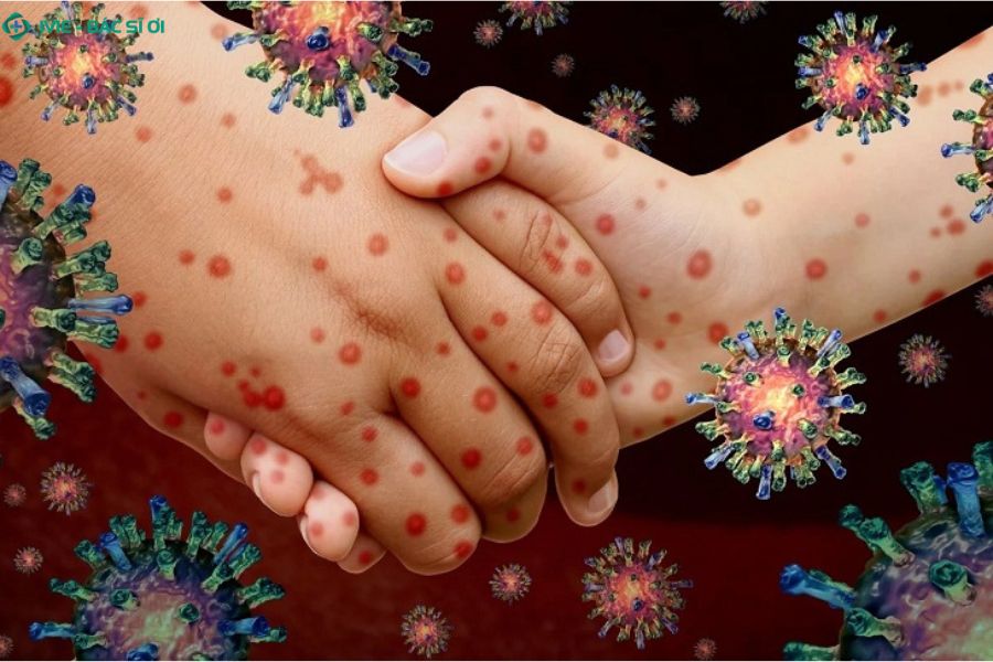 Virus cúm A có thể bám lâu trên tay nắm cửa, bàn ghế, tiền giấy và lây qua tiếp xúc gián tiếp