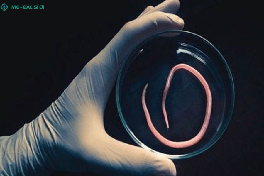 Những điều bạn cần biết về xét nghiệm ký sinh trùng