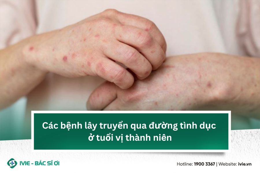 Các bệnh lây truyển qua đường tình dục ở tuổi vị thành niên