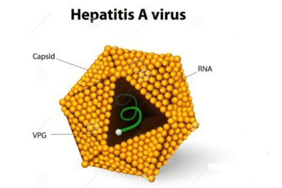 Viêm gan A được gây ra bởi virus viêm gan A (HAV)