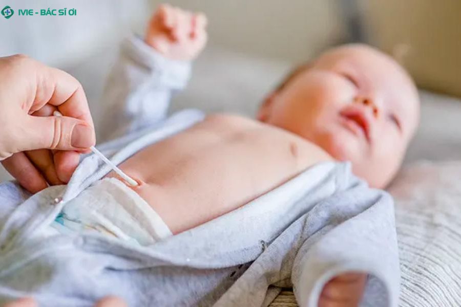 Trẻ 3 tháng tuổi vẫn nên vệ sinh rốn đúng cách