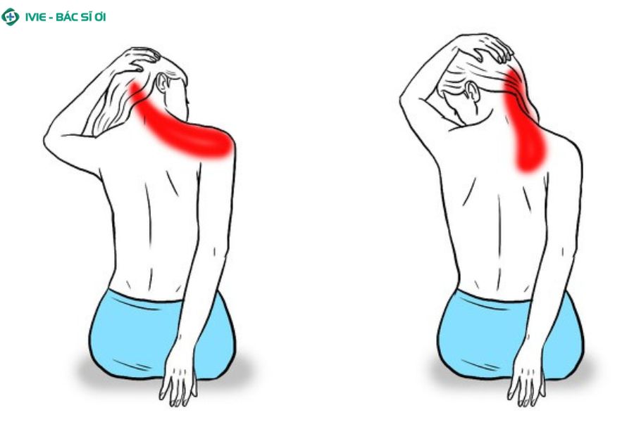 Cách giãn cơ cổ vai gáy đúng cách tại nhà