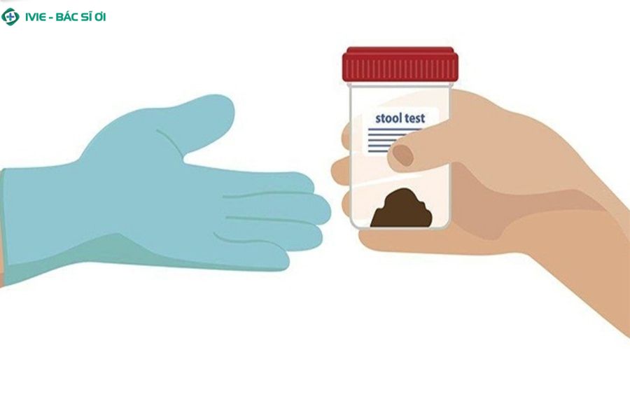Xét nghiệm ký sinh trùng qua phân là phương pháp phổ biến