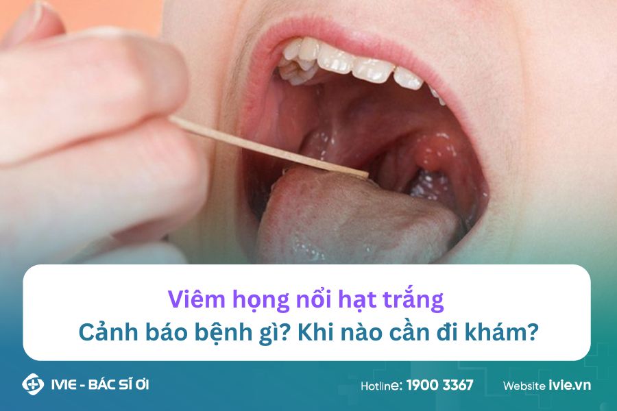 Viêm họng nổi hạt trắng: Cảnh báo bệnh gì? Khi nào cần đi...