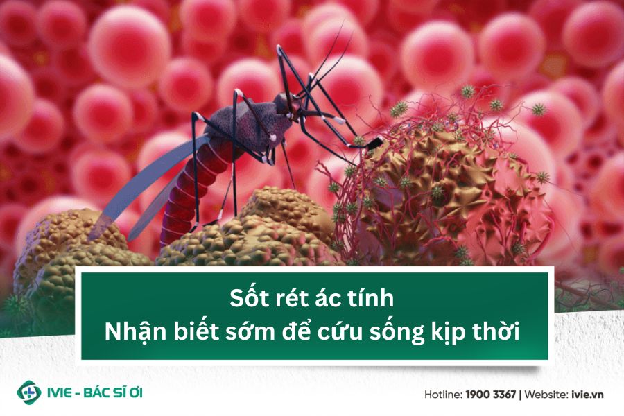 Sốt rét ác tính - Nhận biết sớm để cứu sống kịp thời