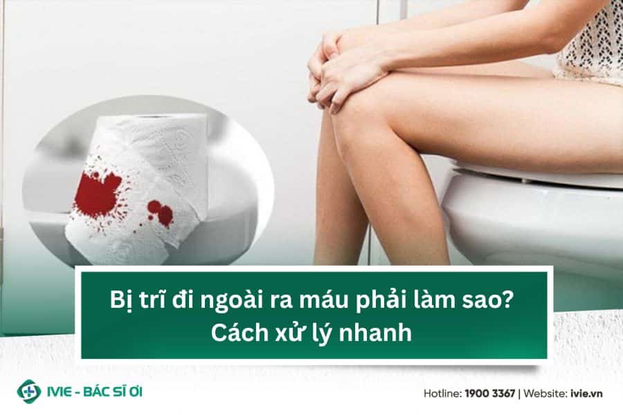 Bị trĩ đi ngoài ra máu phải làm sao? Cách xử lý nhanh