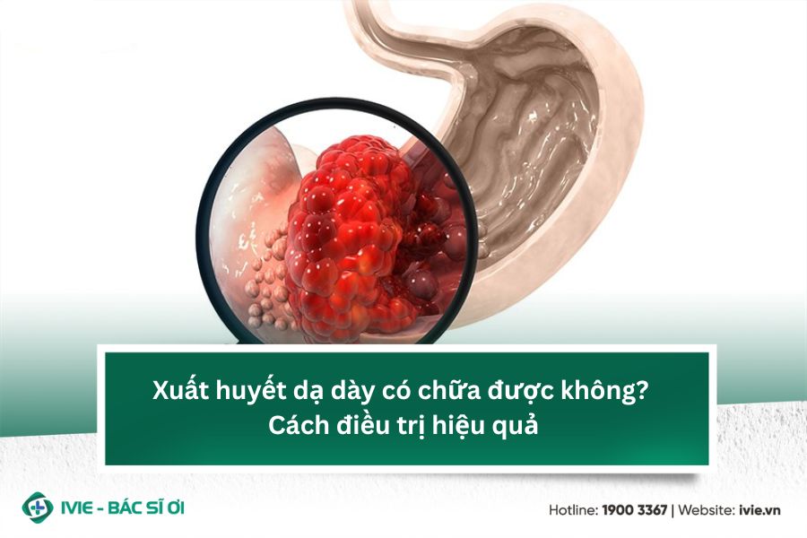 Xuất huyết dạ dày có chữa được không? Cách điều trị hiệu quả